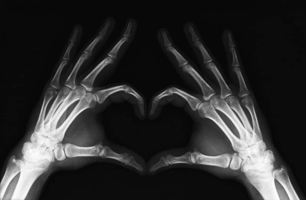 radiographie osseuse